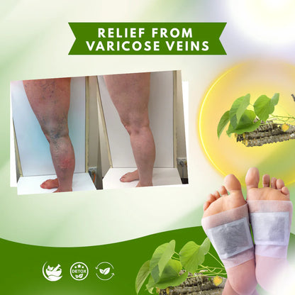 Detox Foot Patches Herbal  🌿✨ (Buy 1 Get 1 Free🔥)